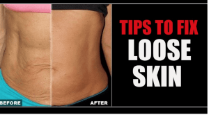6 ways to tighten loose saggy skin