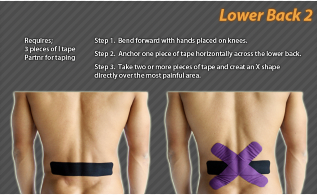 How To Use Kt Tape For Lower Back Pain- Lower back 2