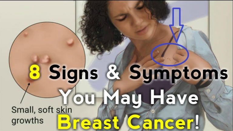 5 Early Signs Of Breast Cancer That Almost All Women Ignore