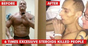 Six Famous People who died of Steroid Overuse!